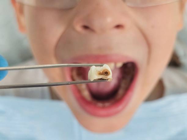 Best Emergency Treatment for Toothache in Richboro, PA